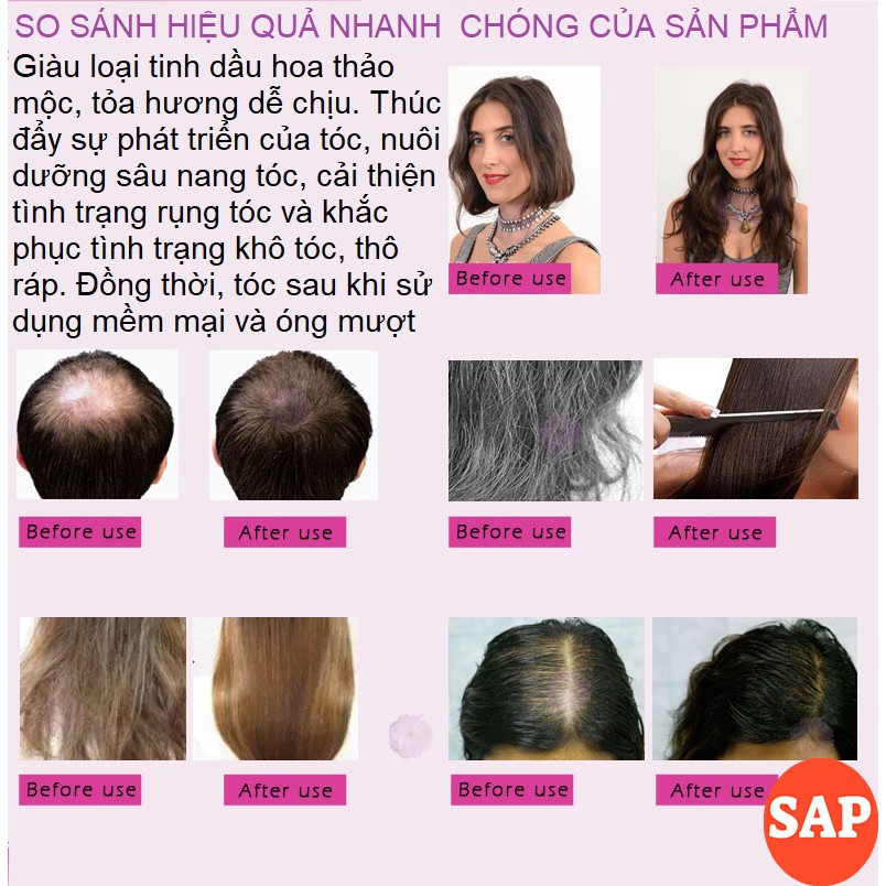 [TÓC BỒNG BỀNH] Tinh chất Mọc Tóc Herbal Hair, Giúp Mọc Tóc Nhanh Chóng, Giảm Rụng Tóc, Nuôi Dưỡng Tóc Bồng Bềnh