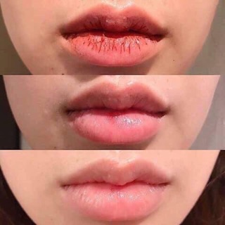 COMBO DƯỠNG MỀM MÔI