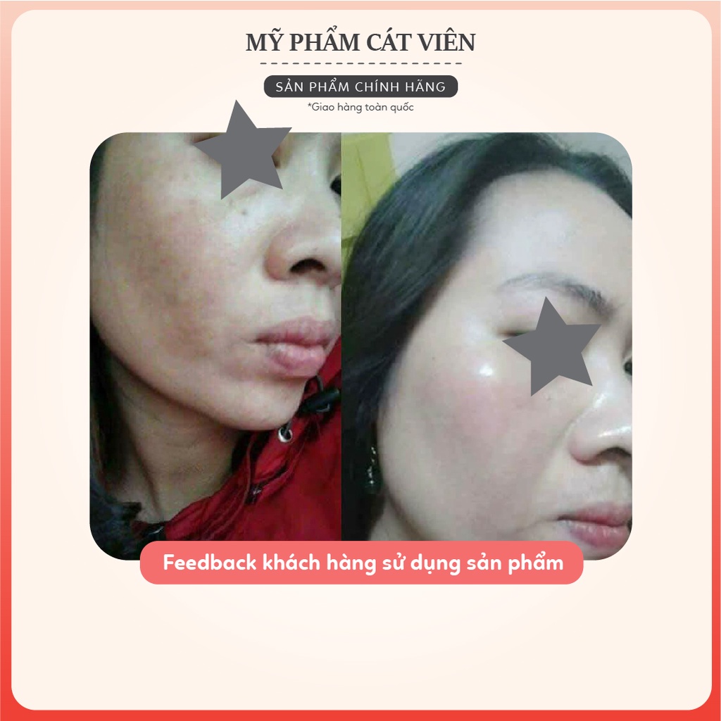 Serum dưỡng trắng Derma, chăm sóc da giảm thâm mờ nám tàn nhang, dưỡng trắng, dưỡng ẩm Me'dream WHITENING SERUM