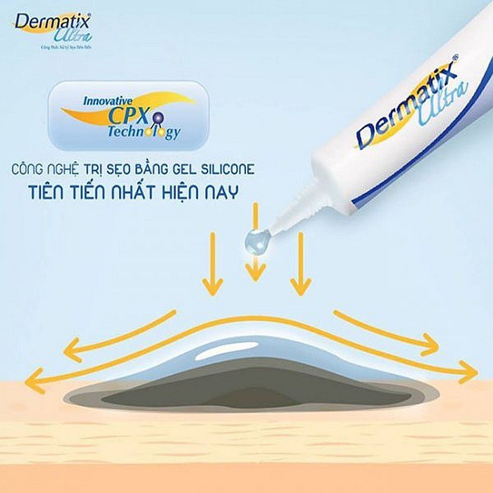 Kem giảm sẹo Dermatix Ultra - Gel hỗ trợ làm lành sẹo hiệu quả - cvspharmacy