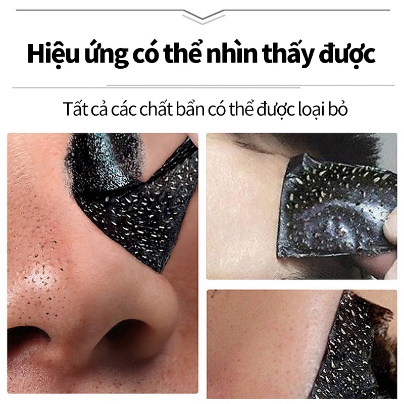 Kem lột da mặt nạ lột mụn đầu đen ở mũi mặt nạ đất sét lột mụn đầu đen than tre 120g