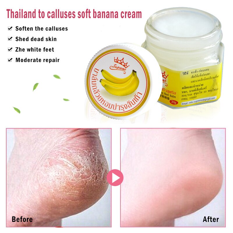 Kem dưỡng da bàn chân chiết xuất 100% từ chuối 20g giúp chống khô nứt nẻ hiệu quả