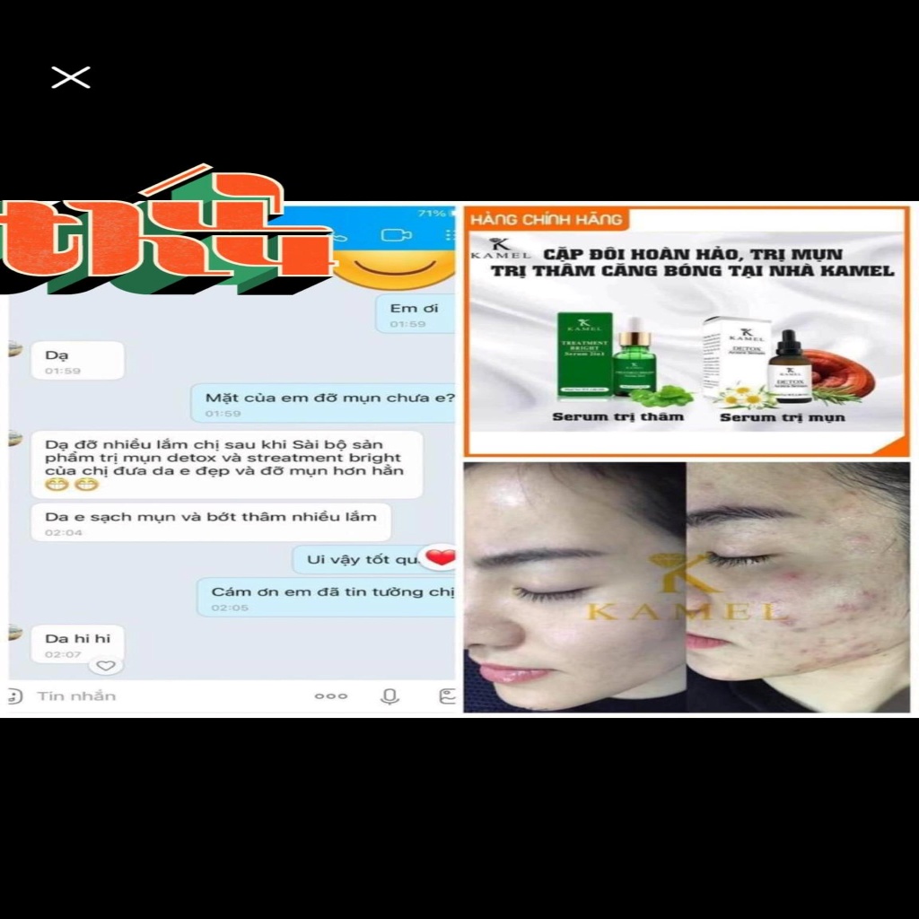 Serum detox acnes Kamel10ml hàng chuẩn công ty