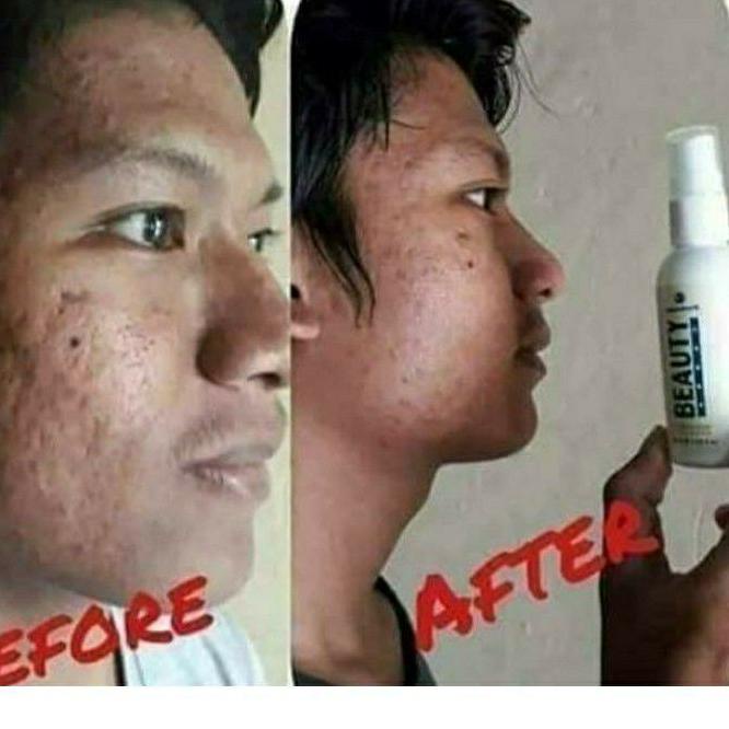 Cái thứ hai này! Tấm trải giường phun sương làm đẹp Lr075 Natura NBS Beuty Biuty Sprey Natura | BigBuy360 - bigbuy360.vn