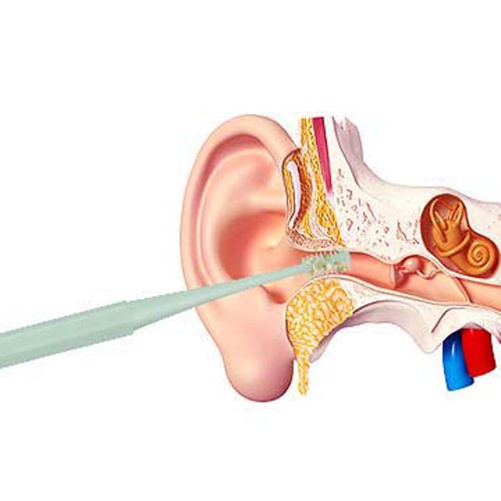 Dụng Cụ Lấy Ráy Tai Hai Đầu An Toàn Tiện Lợi