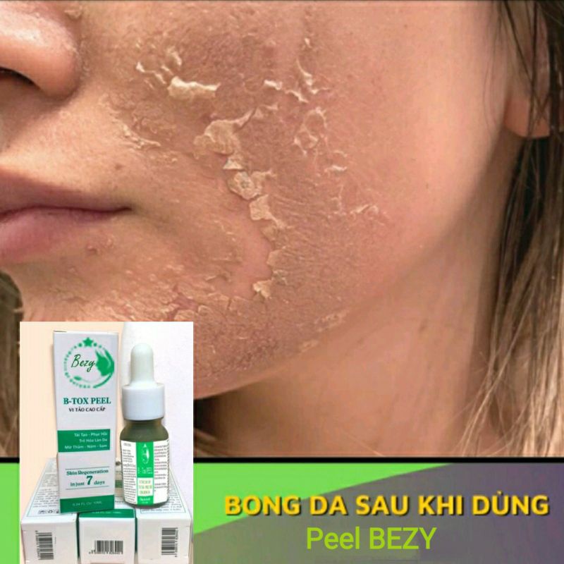 Peel Hút Nám Bong Da Vi Tảo Trắng Da Bezy Cao Cấp