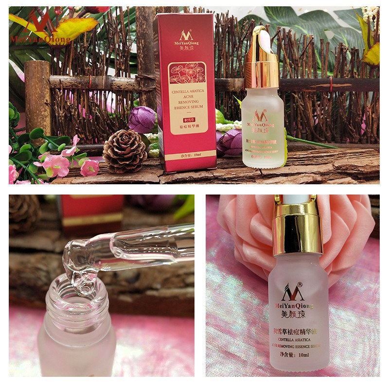 Centella Asiatica Essence Hydrating Control Oil Face Skin Care | BigBuy360 - bigbuy360.vn