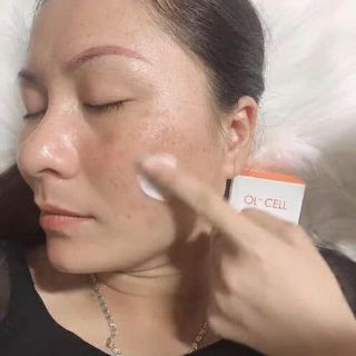 OL+CELL GIẢM NÁM , TÀN NHANG , THÂM HÀN QUỐC