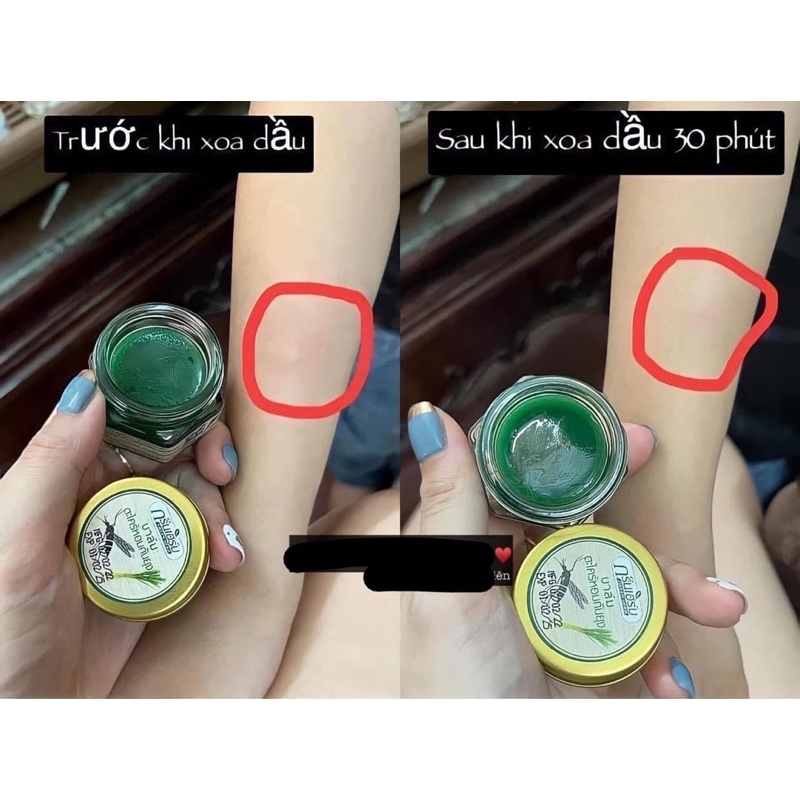 Cao bôi Thươc bôi muỗi đốt côn trùng cắn Thái Lan (Hàng xt trực tiếp) - CÓ SẴN
