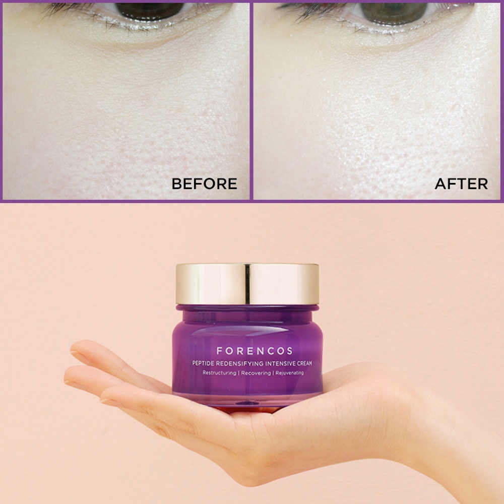 Bộ Kem dưỡng trắng da FORENCOS ngày và đêm 50ml