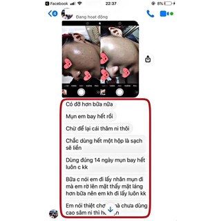 [Chính Hãng]Cao mụn sâm đỏ full size 15g
