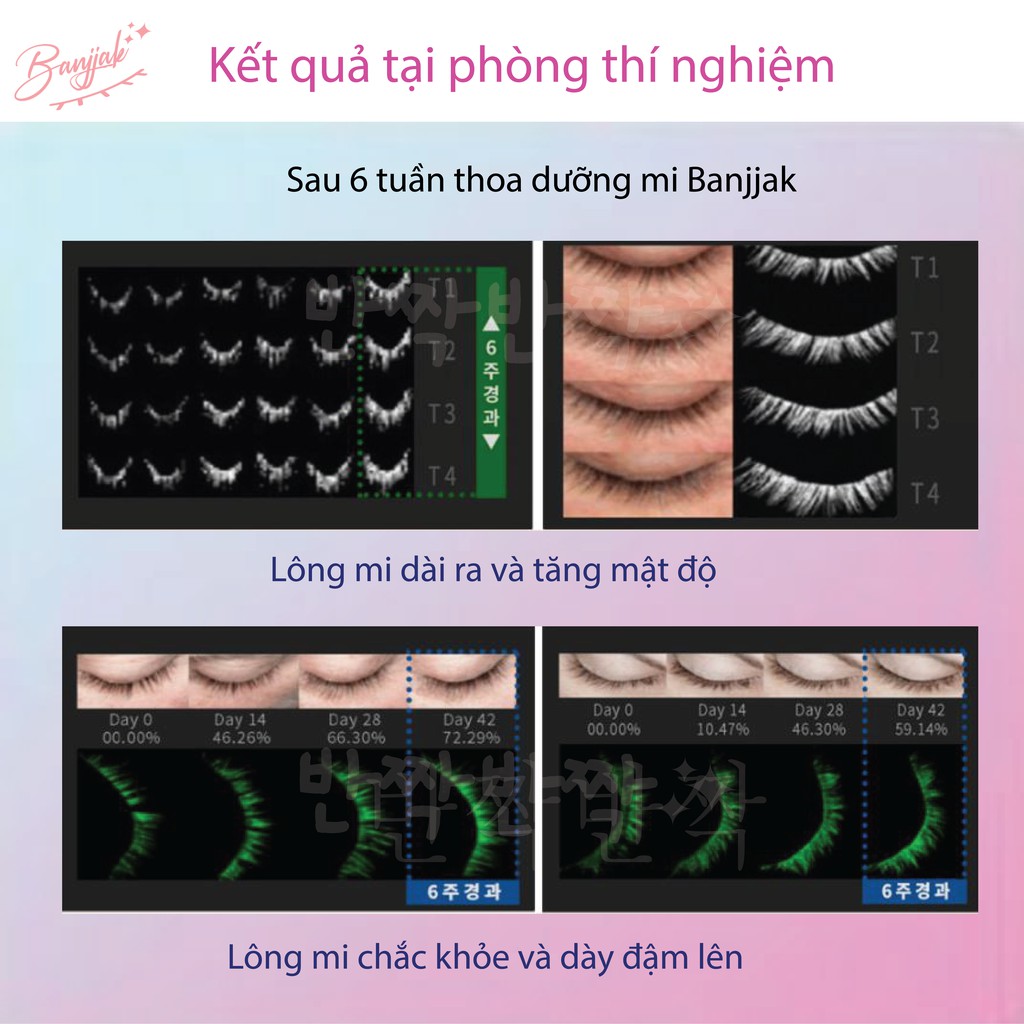 DƯỠNG MI BANJJAK 10ML (Dầu thầu dầu, Vitamin E, Hạnh nhân, Lavender) | BigBuy360 - bigbuy360.vn