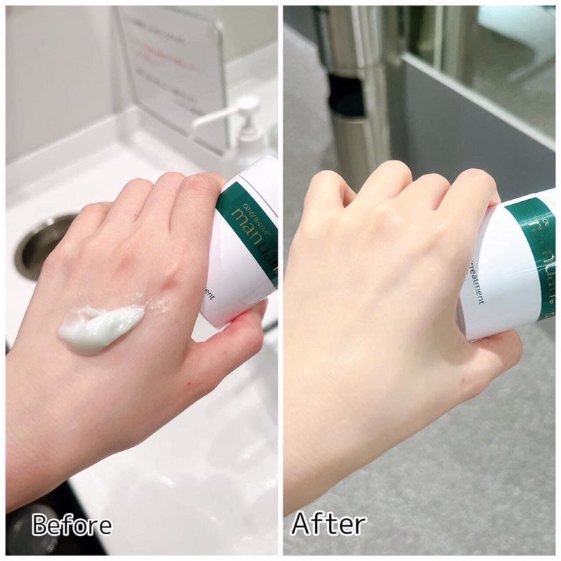 Kem Dưỡng Tay Manuan Cathy Treatment Trẻ Hóa Da Nhật Bản