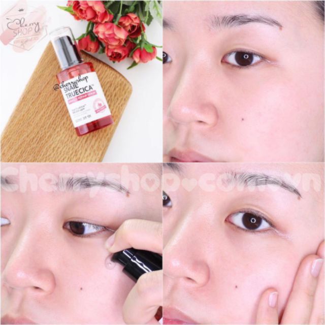 Tinh chất làm mờ sẹo, dưỡng trắng some by mi snail truecica miracle repair 50ml | BigBuy360 - bigbuy360.vn