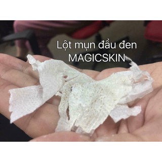 GEL LỘT MỤN ĐẦU ĐEN Magic