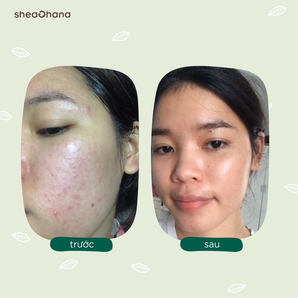 Serum phục hồi da SheaGhana Renew Serum 10% PHA 30gr