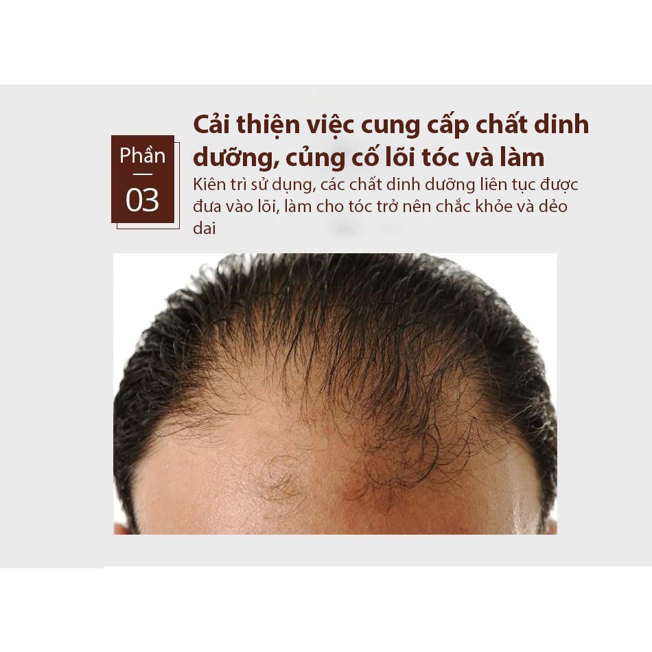VIBRANT GLAMOUR Tinh chất mọc tóc serum phục hồi & nuôi dưỡng tóc hư tổn kích thích mọc tóc dạng xịt 30ml