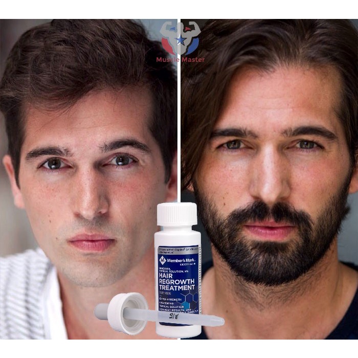 Tinh Chất Mọc Tóc và Râu MINOXIDIL 5% Hair Regrowth Treatment