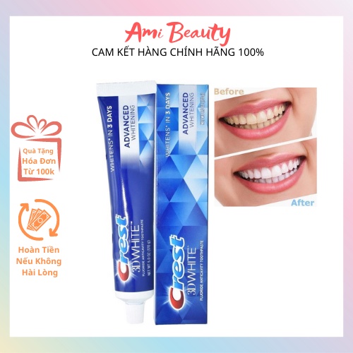 KEM ĐÁNH RĂNG CREST 3D WHITE ADVANCED TRIPLE WHITENING 158G