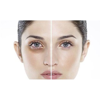 Serum trẻ hóa vùng mắt