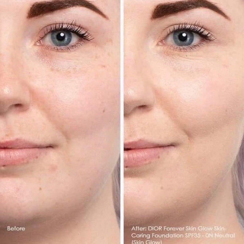 Kem nền Dior Forever Skin Glow Foundation