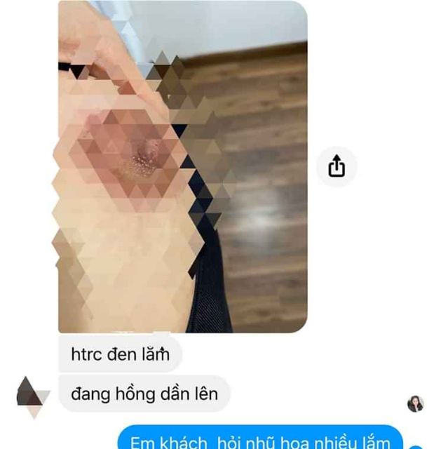 Kem làm  hồng môi nhũ hoa vùng kín | BigBuy360 - bigbuy360.vn