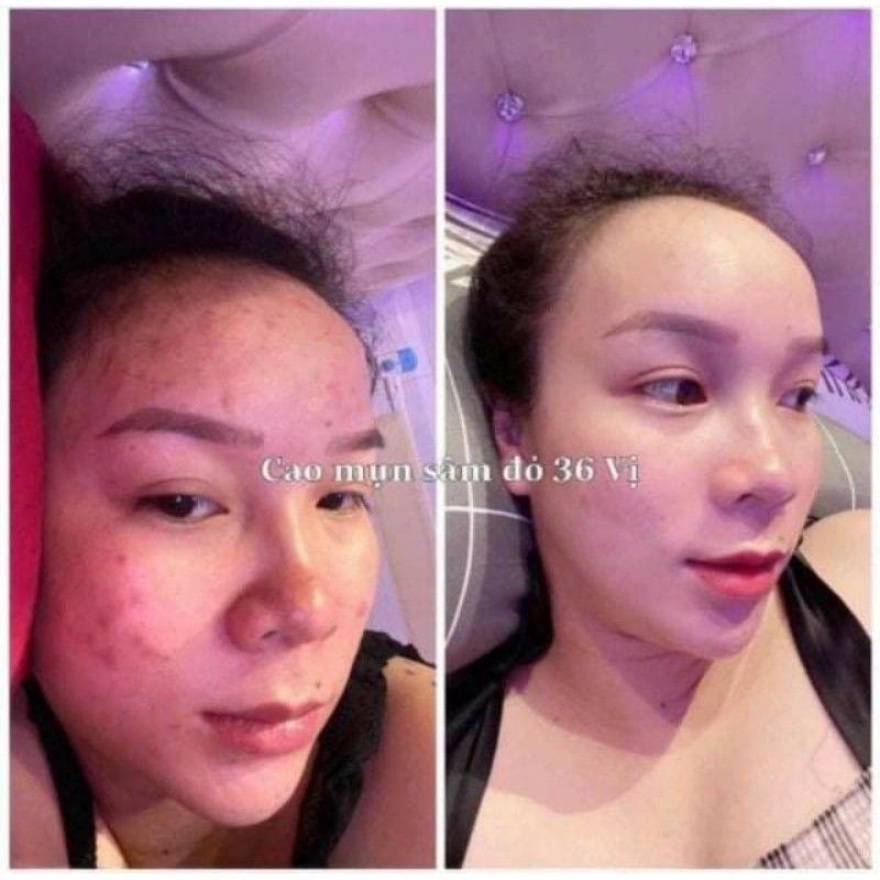 CAO MUN SAM DO | BigBuy360 - bigbuy360.vn