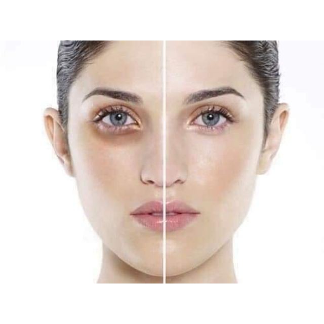 Combo 5 - 10 Gói Sample Kem mắt xóa thâm ,chống nhăn, trẻ hóa làn da vùng mắt su:m37 Fleur eye cream 1ml | BigBuy360 - bigbuy360.vn