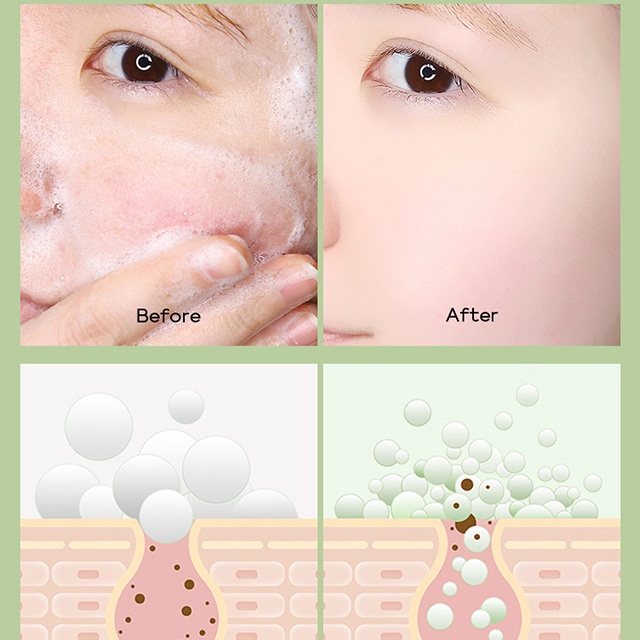 Sữa Rửa Mặt Trà Xanh Fenyi Ngăn Ngừa Mụn Kiểm Soát DầuGreen Tea Mild Cleanser 50g