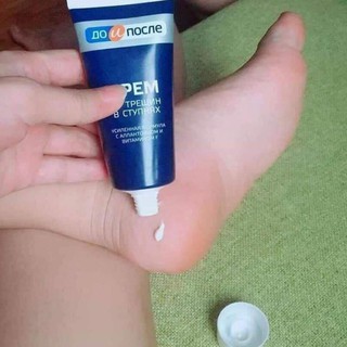 [ Hàng Chính Hãng] Kem Nứt Gót Chân Kpem Nga 50ml