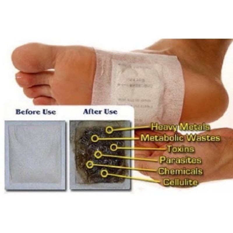 Sale 38% Combo10 Miếng Dán Chân Thải Độc Detox Lanna Foot Patch