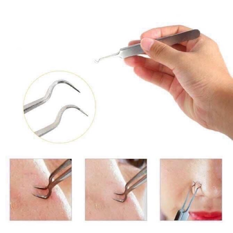 Nhíp Gắp Mụn Vacosi giúp lấy nhân mụn dễ dàng an toàn vệ sinh