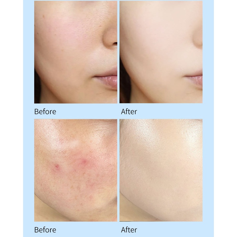 Kem nền che khuyết điểm chống thấm nước và lâu trôi cao cấp