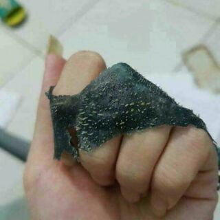 LỘT MỤN NELLYP