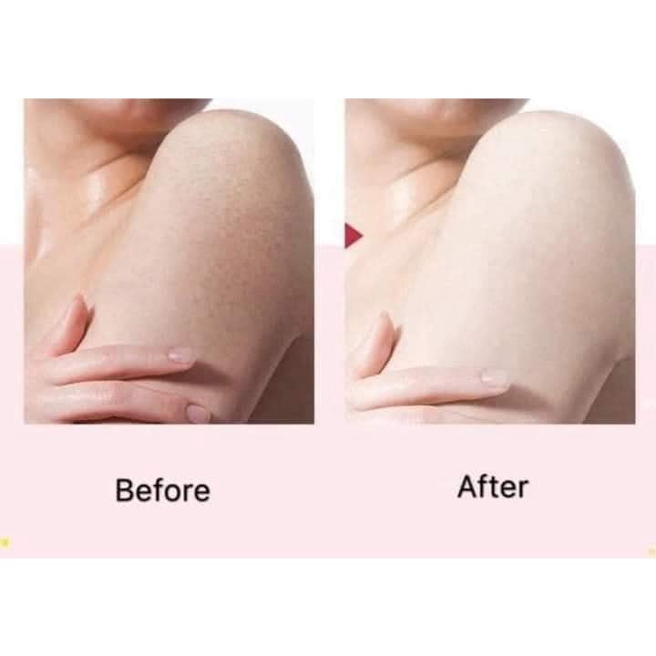 Gel tẩy tế bào chết Spa