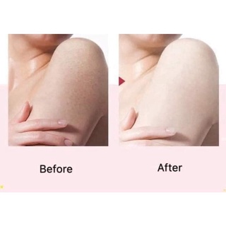 Gel tẩy tế bào chết Spa (tuýp)