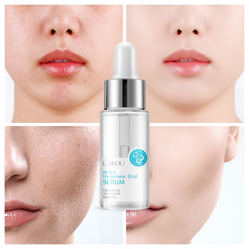 Bộ kem dưỡng phục hồi da 3 món LAIKOU dưỡng da mặt axit hyaluronic 25g + dưỡng da mắt 30g + Serum 17ml