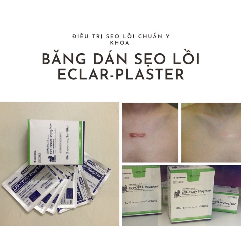 Miếng Dán Ép Sẹo Lồi Eclar Plaster Hisamitsu Nhật Bản