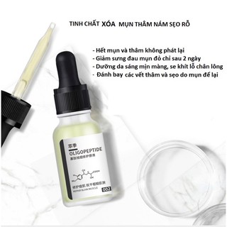 Serum Giảm Mụn Mờ thâm dưỡng trắng da