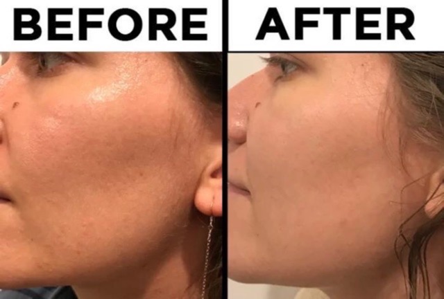 [AUTH BILL MỸ] Tinh chất dưỡng da The Ordinary Niacinamide 10% + Zinc 1% | BigBuy360 - bigbuy360.vn