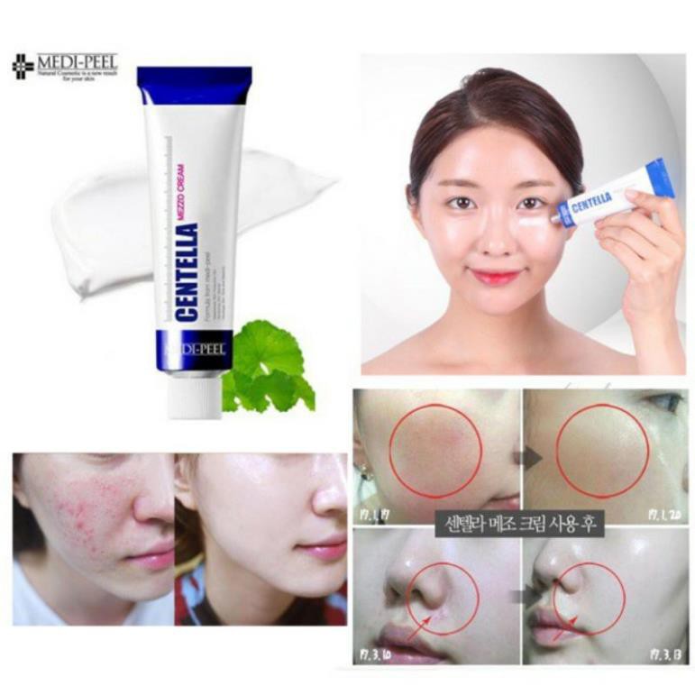 Kem Ngừa Mụn Rau Má Medi-Peel Centella Mezzo Cream - Medi Peel