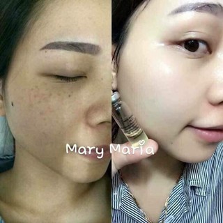 Collagen tươi Teana C1 - Nga