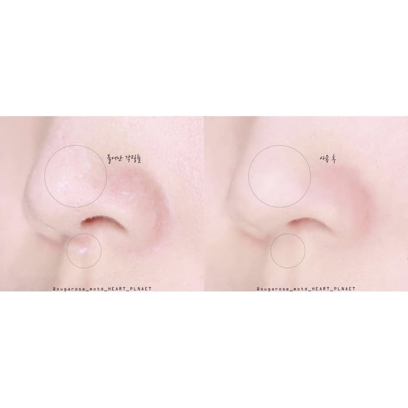 THANH LĂN MỤN ĐẦU ĐEN RED PEEL HÀN QUỐC