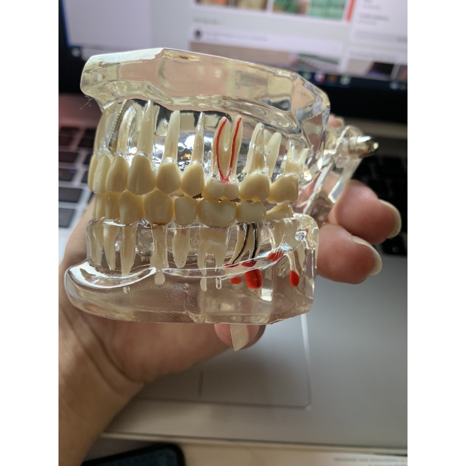 [Hàng mới về] Mô hình hàm răng đa năng chuyên dụng dành cho nha khoa