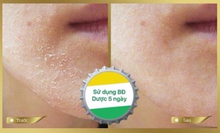 Serum Bạch Đan Dược