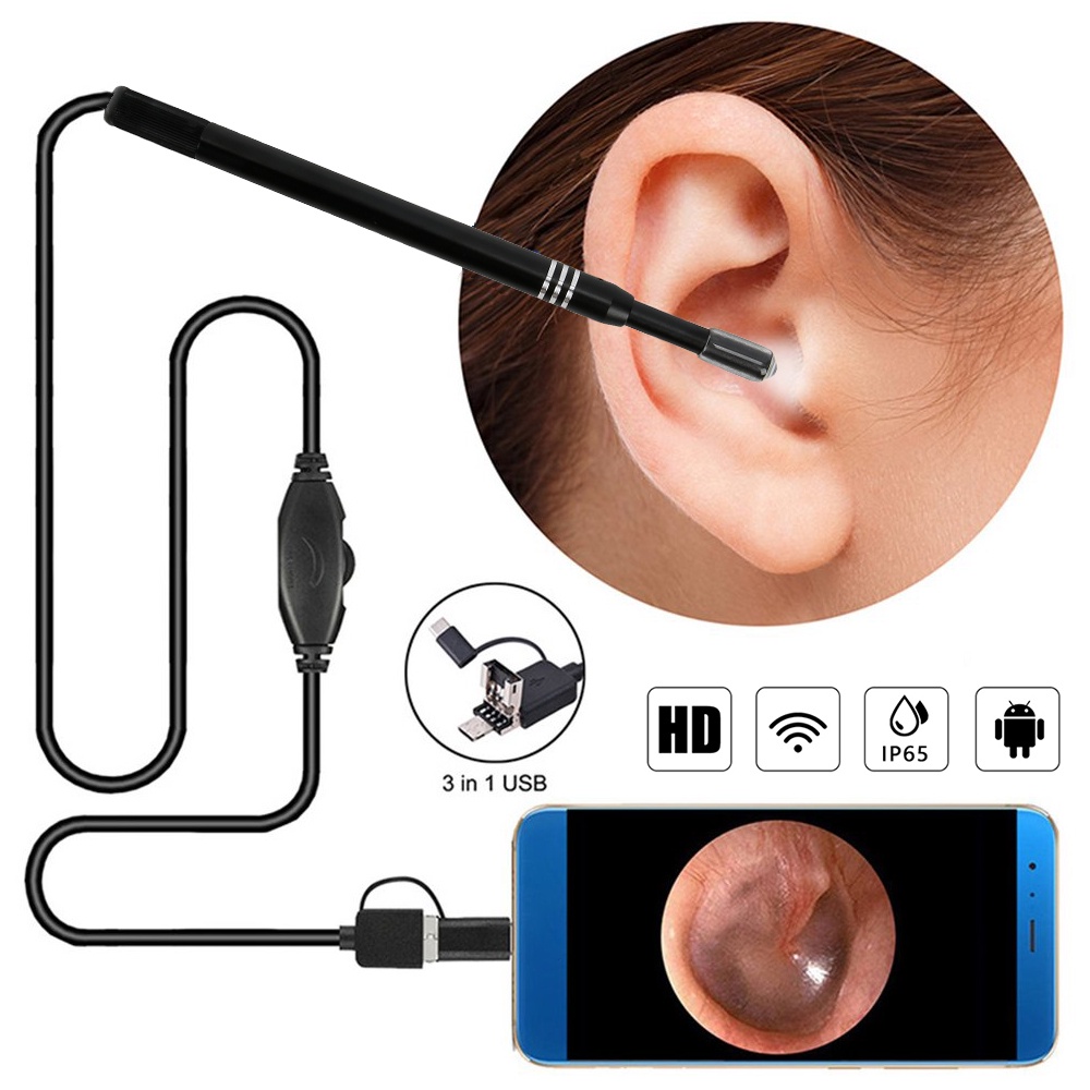 Bộ Lấy Ráy Tai Có Camera, Camera Nội Soi Tai, Mũi, Họng Siêu Nét Bảo Hành 12 Tháng