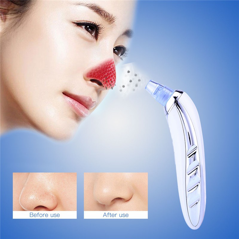 Máy loại bỏ mụn đầu đen Kemei hút chân không làm sạch gương mặt