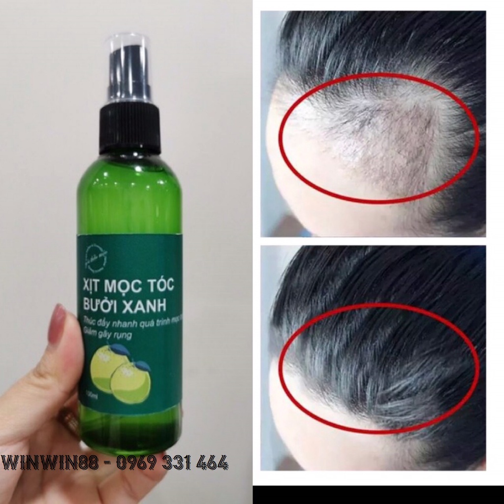 CHAI XỊT KÍCH THÍCH MỌC TÓC CHIẾT XUẤT BƯỞI XANH 100ML