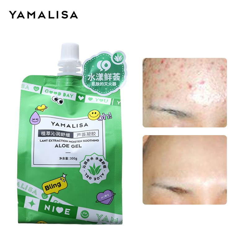 Gel lô hội YAMALISA 300g dưỡng da