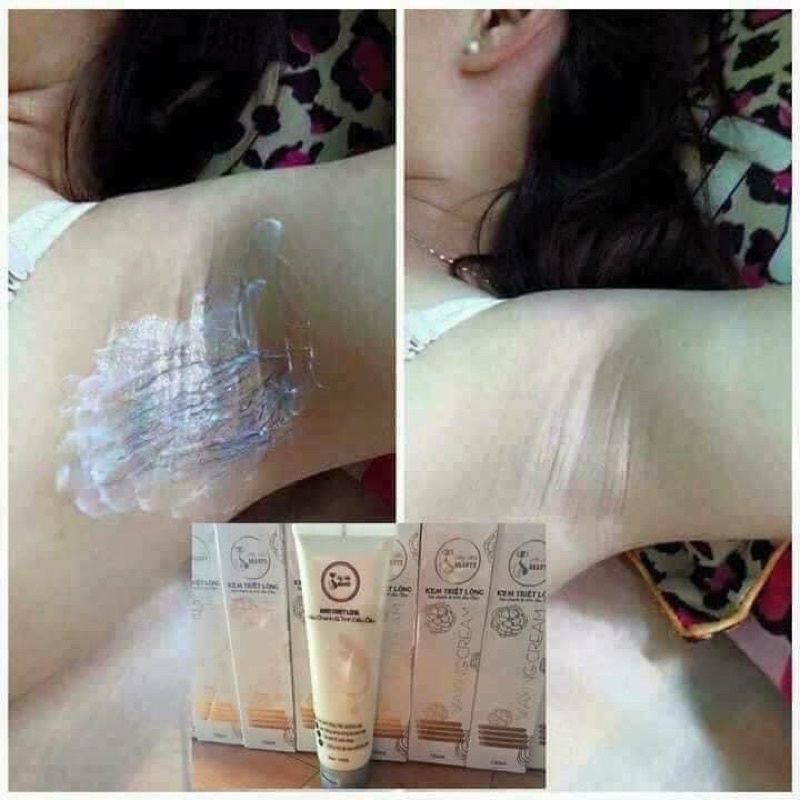 KEM TRIỆT LÔNG VĨNH VIỄN MY MIU- giảm, thưa dần nếu kiên trì